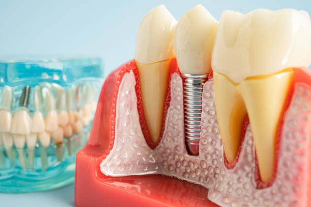 Best General Dentistry  in , CO